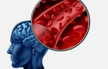 síntomas de osteocondrosis de la columna cervical
