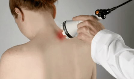 tratamiento de la osteocondrosis cervical mediante métodos fisioterapéuticos