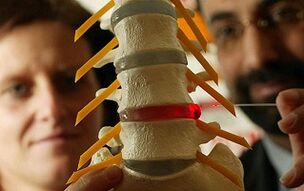 Síntomas y tratamiento de la osteocondosis de la columna torácica