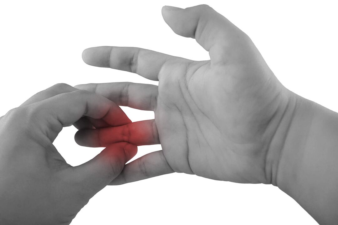 Inflamación de las articulaciones de los dedos como causa de dolor.